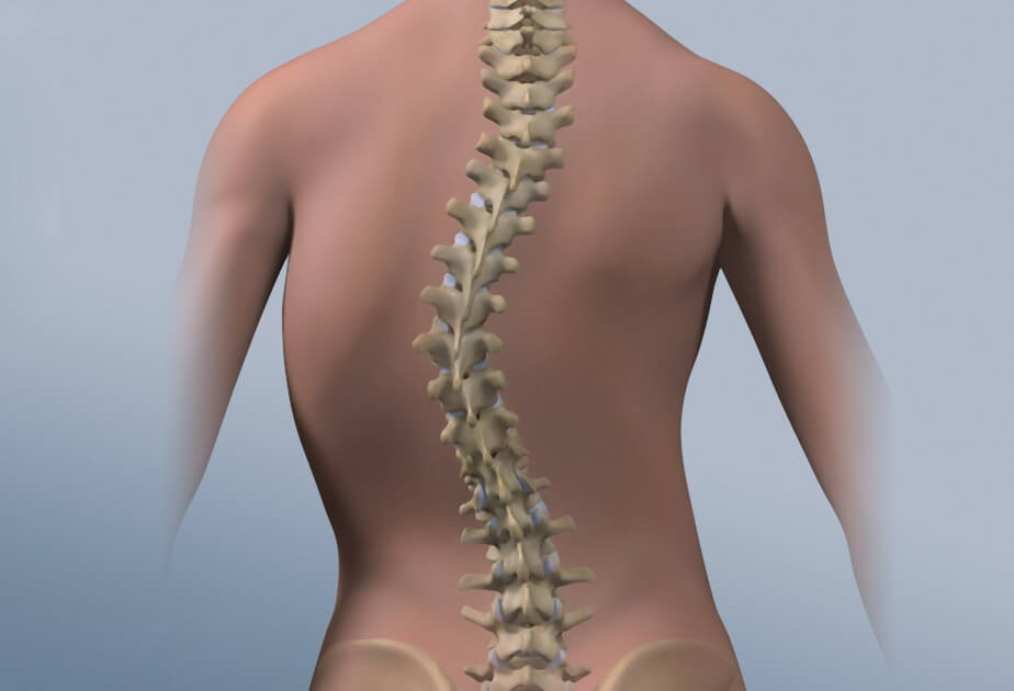 علل و درمان انحراف ستون ف