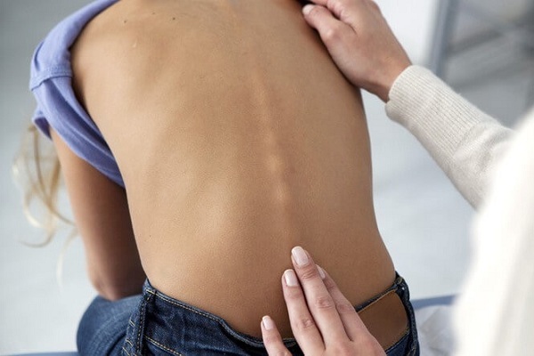 درمان انحراف ستون فقرات