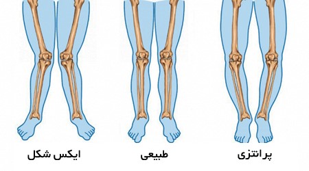 پای پرانتزی